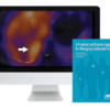 A Practical and Current Approach for Managing Incidental Findings