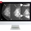 Breast Imaging Screening and Diagnosis