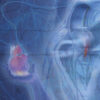 Cardiovascular Review Course for Cardiology Boards and Recertification VideosPDF
