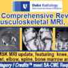 Duke Radiology A Comprehensive Review of Musculoskeletal MRI 2nd Edition Agenda