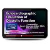 Echocardiographic Evaluation of Diastolic Function