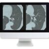 Lung Cancer Screening A Comprehensive Guide Online Course