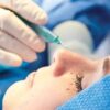 Plastic and Reconstructive Surgery A Comprehensive Review 2016 – Videos PDF