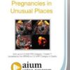 Pregnancies in Unusual Places