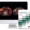 The Radiology M and M Meeting Misinterpretations Misses and Mimics