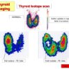 Thyroid Imaging
