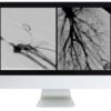 Vascular and Interventional Radiology