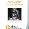 acute cardiac ultrasound cases aium video hd acute cardiac ultrasound cases aium video hd