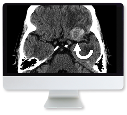 Clinical Case-Based Review of Neuroradiology