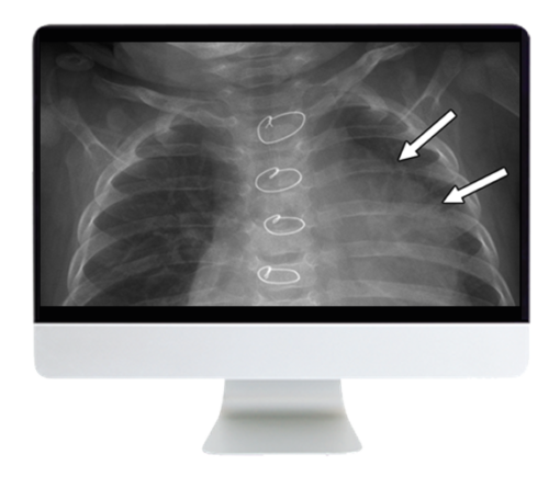 Clinical Case-Based Review of Pediatric Imaging