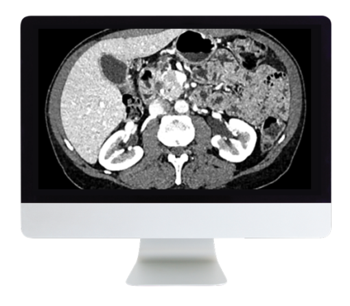 Gastrointestinal Imaging