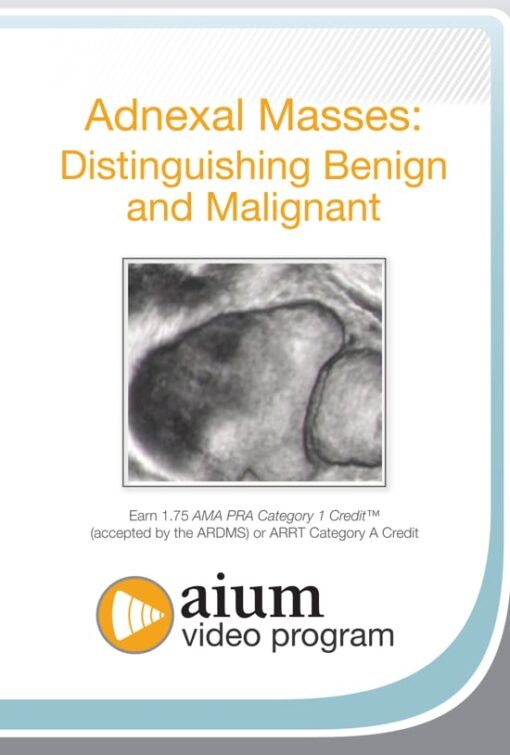 Adnexal Masses: Distinguishing Benign and Malignant