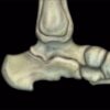 1637397139 814421951 mri mastery series ankle 2017 nbsp