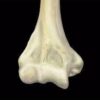 1637397475 1512696891 mri mastery series elbow 2021