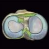 1637397611 1058539198 mri mastery series knee 2021