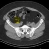 1637742419 1780042022 mrionline imaging mastery series appendix 2021