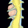 1638608586 80454222 mrionline mri mastery series extradural lesions 2020