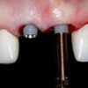 1639037378 847888374 online residency program a z in implant dentistry 2021