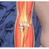 1639211772 545283133 2020 mayo clinic quot teach the teachers quot elbow course forging the future