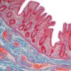 1645264702 991940412 current topics in gastrointestinal and liver pathology 2022