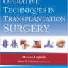 Operative Techniques in Transplantation Surgery