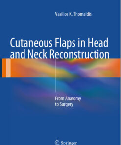 Ebook  Cutaneous Flaps in Head and Neck Reconstruction: From Anatomy to Surgery 2014th Edition