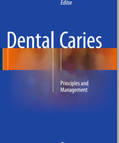 Ebook Dental Caries: Principles and Management 1st ed. 2016 Edition