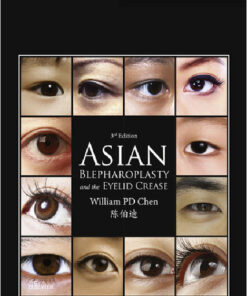 Asian Blepharoplasty and the Eyelid Crease, 3e 3rd Edition