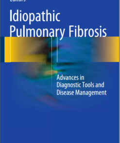 Idiopathic Pulmonary Fibrosis: Advances in Diagnostic Tools and Disease Management 1st ed. 2016 Edition