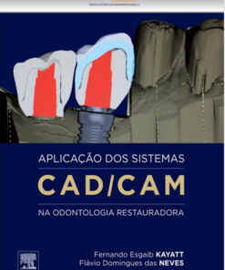 Aplicação dos Sistemas CAD/CAM na Odontologia Restauradora (Em Portuguese do Brasil)