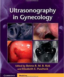 Ultrasonography in Gynecology 1st Edition