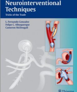 Neurointerventional Techniques: Tricks of the Trade 1st edition