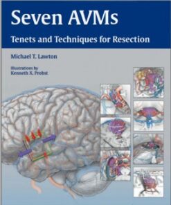 Seven AVMs: Tenets and Techniques for Resection 1st Edition