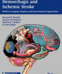 Hemorrhagic and Ischemic Stroke: Medical, Imaging, Surgical and Interventional Approaches 1st Edition