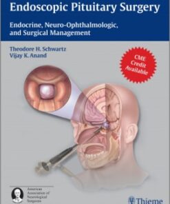 Endoscopic Pituitary Surgery: Endocrine, Neuro-Ophthalmologic, and Surgical Management 1st edition