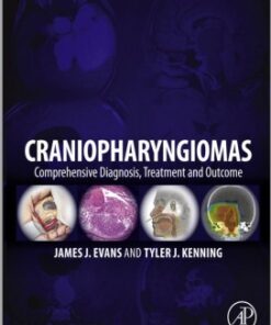 Craniopharyngiomas: Comprehensive Diagnosis, Treatment and Outcome 1st Edition