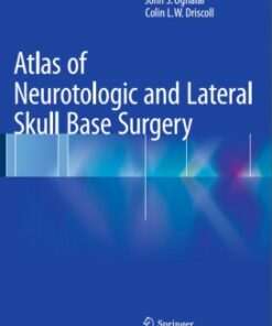 Atlas of Neurotologic and Lateral Skull Base Surgery 1st ed. 2016 Edition