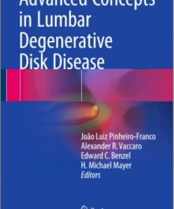 Advanced Concepts in Lumbar Degenerative Disk Disease 1st ed. 2016 Edition
