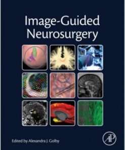 Image-Guided Neurosurgery 1st Edition