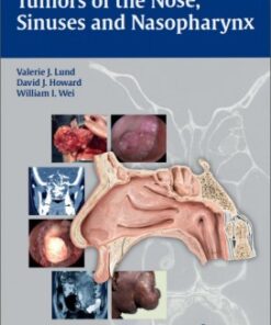 Tumors of the Nose, Sinuses and Nasopharynx 1st edition Edition