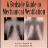 A Bedside Guide To Mechanical Ventilation
