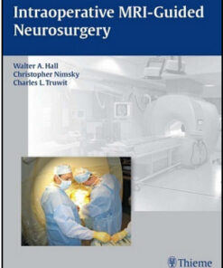 Intraoperative MRI-Guided Neurosurgery 1st Edition