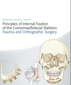 Principles of Internal Fixation of the Craniomaxillofacial Skeleton: Trauma and Orthognathic Surgery