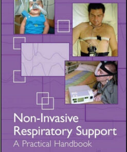 Non-Invasive Respiratory Support: A Practical Handbook, 3d Edition