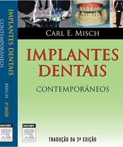 Implantes Dentais Contemporâneos, 3ª Edição