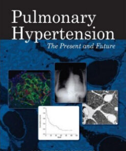 Pulmonary Hypertension 1st Edition