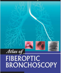 Atlas of Fiberoptic Bronchoscopy 1st Edition
