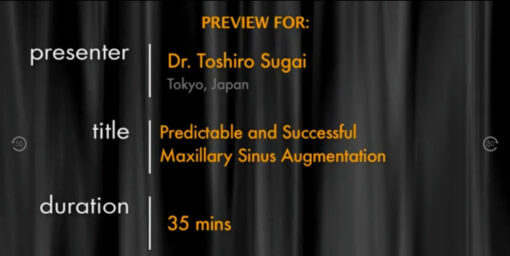 Predictable and Successful Maxillary Sinus Augmentation