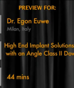 High End Implant Solutions for Patients with an Angle Class II Downhill Dentition