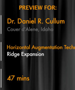 Horizontal Augmentation Techniques: Ridge Expansion